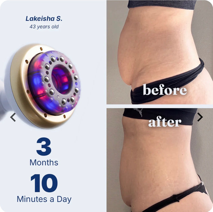 Electric Gua Sha Cupping Body Massager – 9-Speed Rechargeable